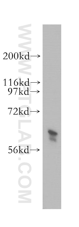 Western Blot (WB) analysis of PC-3 cells using TROVE2 Polyclonal antibody (12718-1-AP)