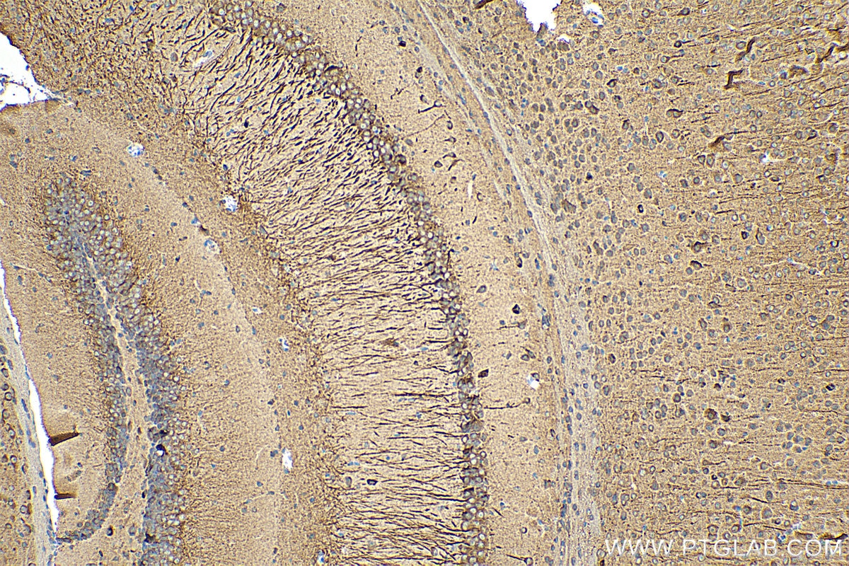 Immunohistochemistry (IHC) staining of mouse brain tissue using TROVE2 Monoclonal antibody (67149-1-Ig)