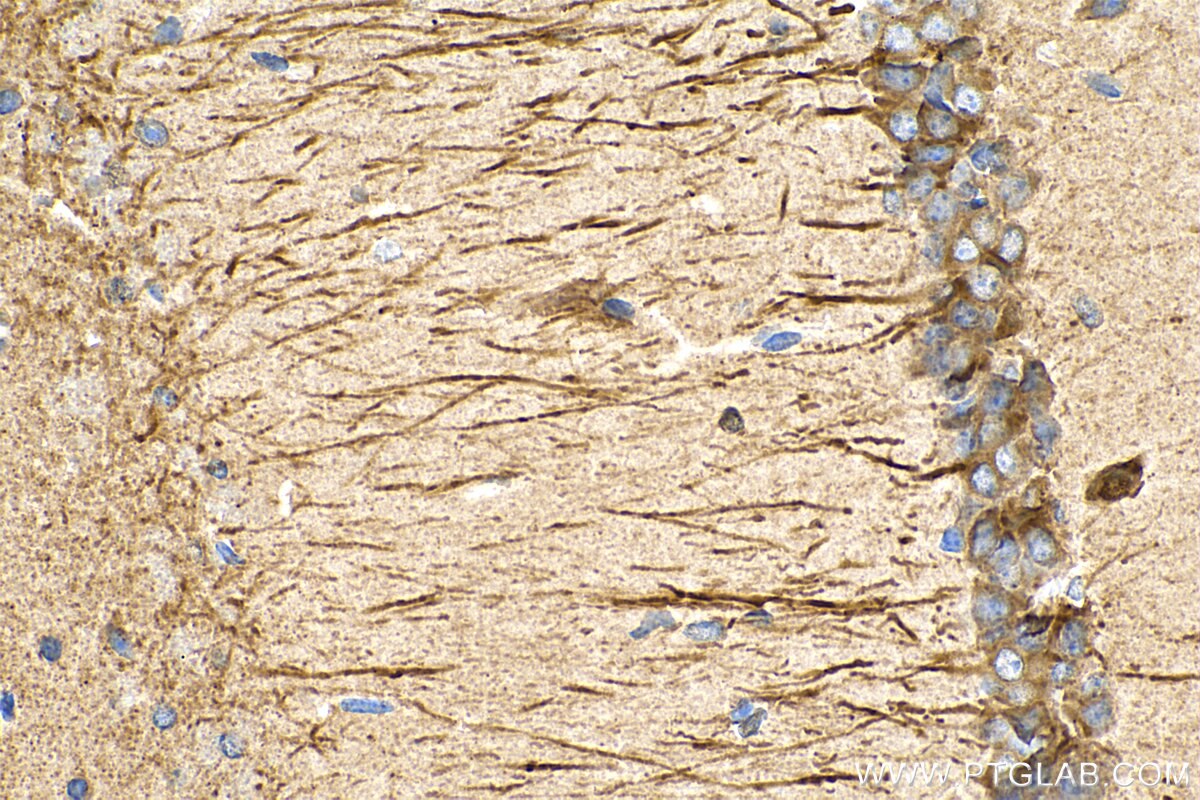 Immunohistochemistry (IHC) staining of mouse brain tissue using TROVE2 Monoclonal antibody (67149-1-Ig)