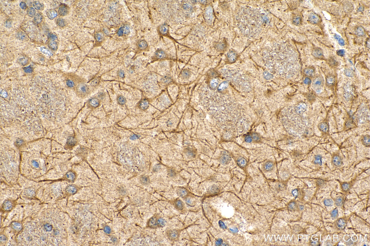 Immunohistochemistry (IHC) staining of mouse brain tissue using TROVE2 Monoclonal antibody (67149-1-Ig)