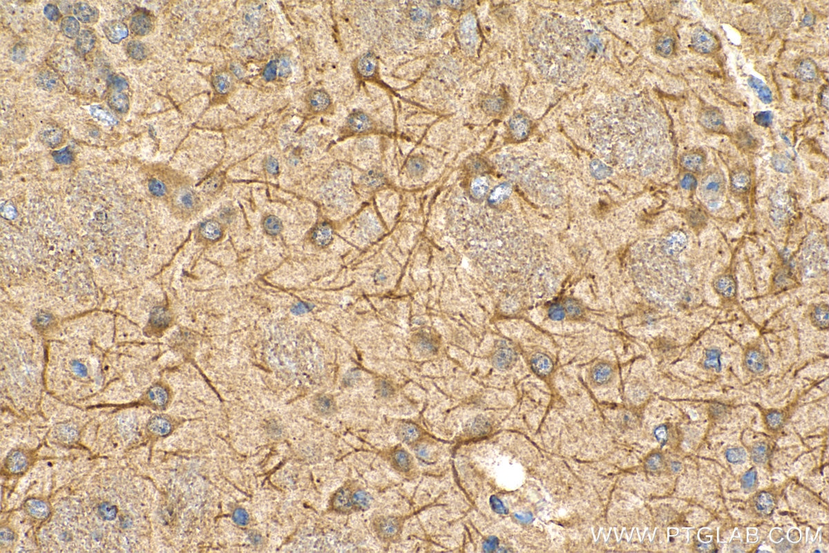 Immunohistochemistry (IHC) staining of mouse brain tissue using TROVE2 Monoclonal antibody (67149-1-Ig)