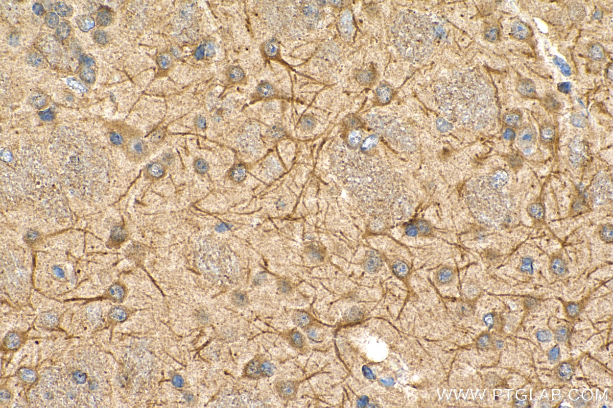 IHC staining of mouse brain using 67149-1-Ig