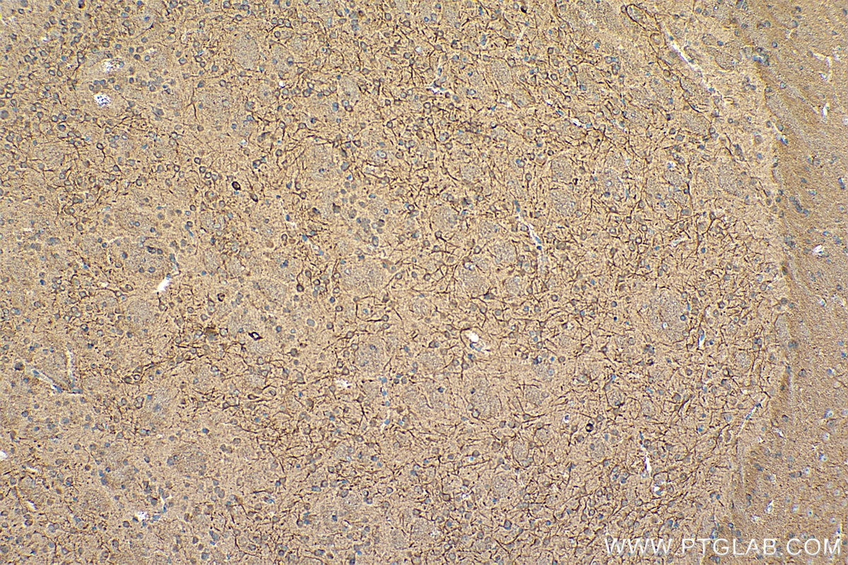 Immunohistochemistry (IHC) staining of mouse brain tissue using TROVE2 Monoclonal antibody (67149-1-Ig)