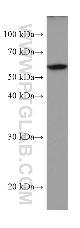 Western Blot (WB) analysis of MCF-7 cells using TROVE2 Monoclonal antibody (67149-1-Ig)