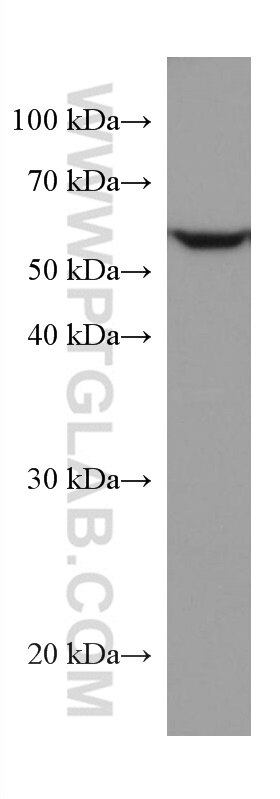 Western Blot (WB) analysis of Jurkat cells using TROVE2 Monoclonal antibody (67149-1-Ig)