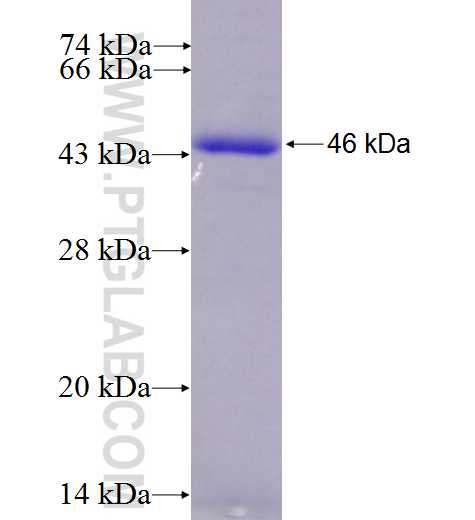 TROVE2 fusion protein Ag4379 SDS-PAGE