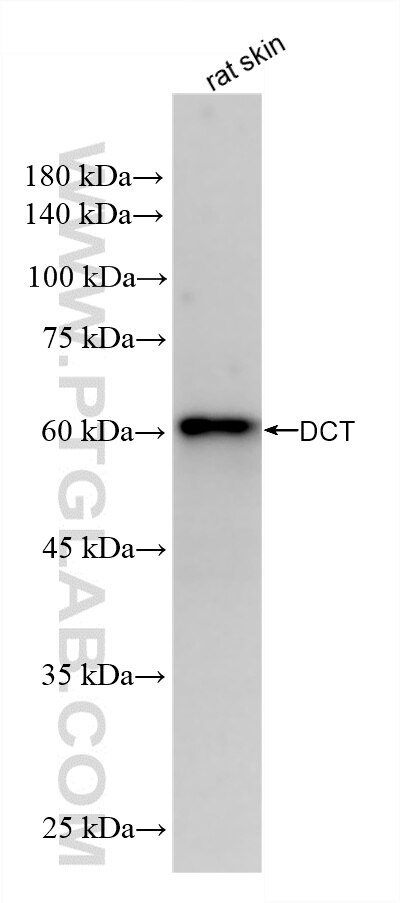 WB analysis using 88100-1-RR (same clone as 88100-1-PBS) Western Blot (WB) analysis of various lysates using TRP2/DCT Recombinant monoclonal antibody (88100-1-RR)