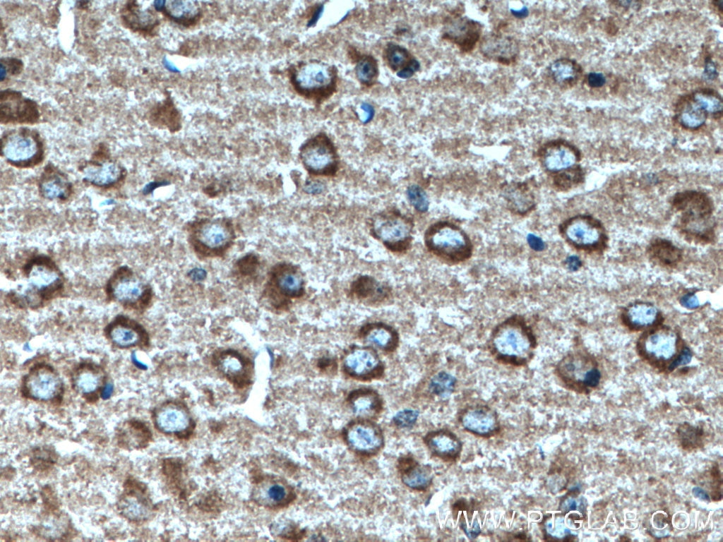 Immunohistochemistry (IHC) staining of mouse brain tissue using TRPA1 Polyclonal antibody (19124-1-AP)