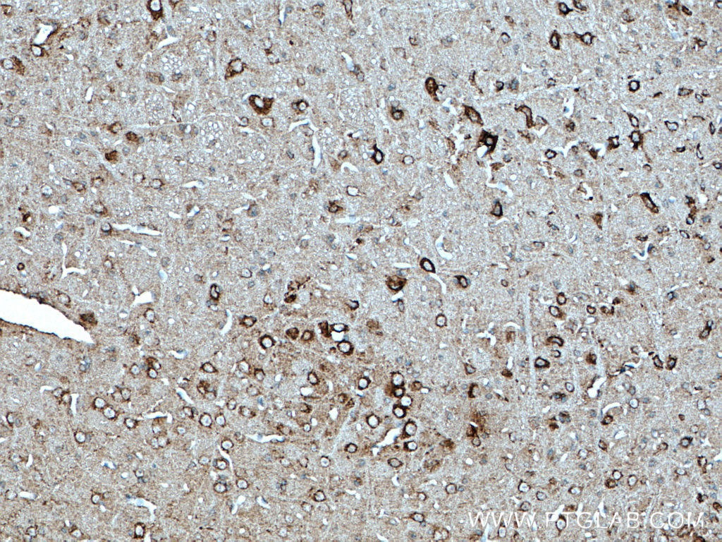 Immunohistochemistry (IHC) staining of mouse cerebellum tissue using TRPA1 Polyclonal antibody (19124-1-AP)