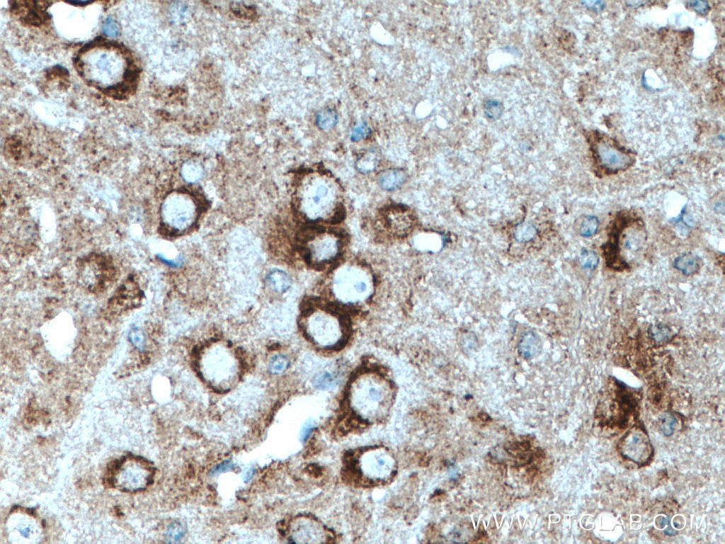 Immunohistochemistry (IHC) staining of mouse cerebellum tissue using TRPA1 Polyclonal antibody (19124-1-AP)