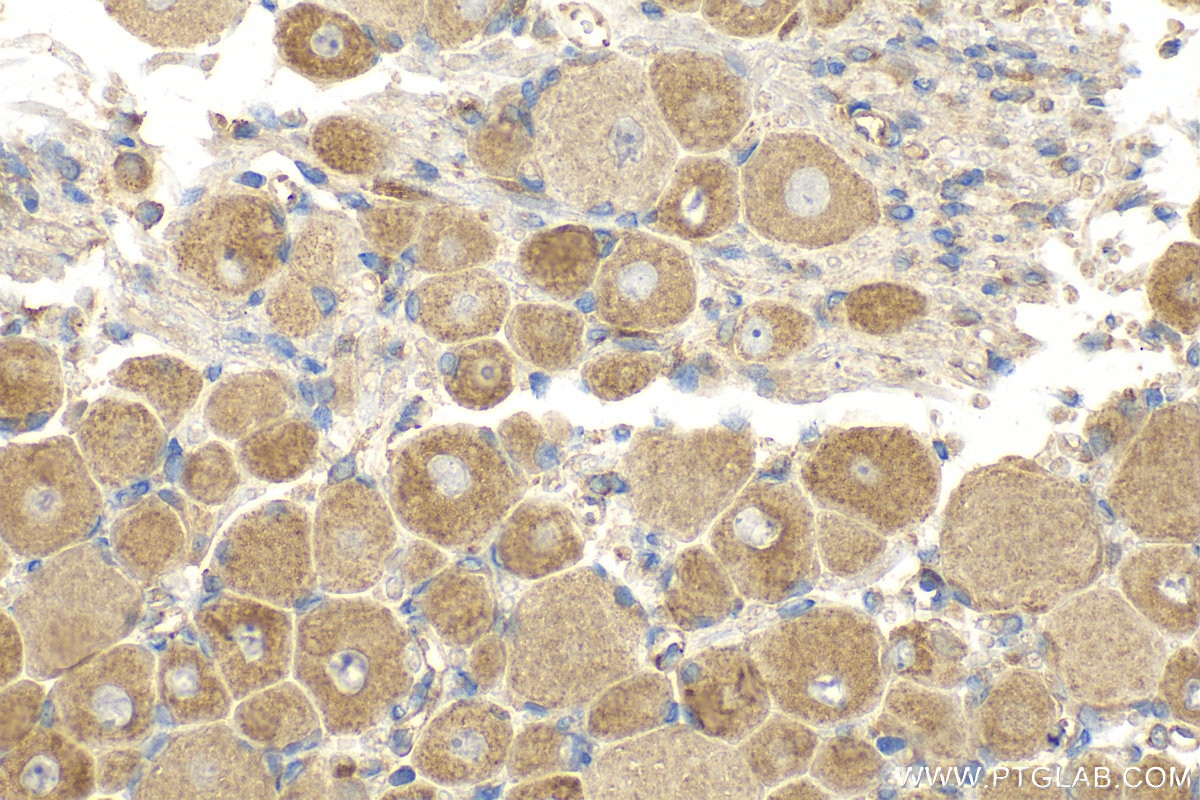 Immunohistochemistry (IHC) staining of rat dorsal root ganglion tissue using TRPA1 Polyclonal antibody (19124-1-AP)