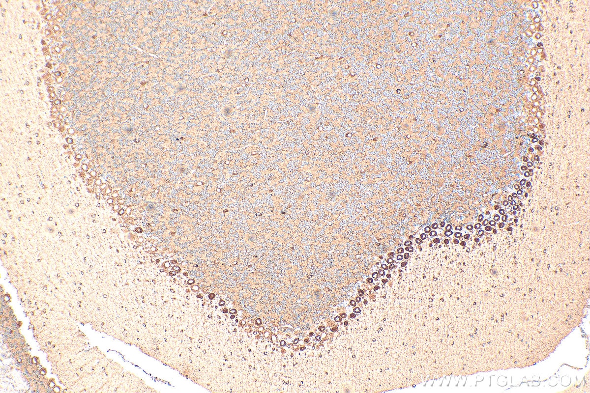 Immunohistochemistry (IHC) staining of mouse cerebellum tissue using TRPA1 Polyclonal antibody (19124-1-AP)