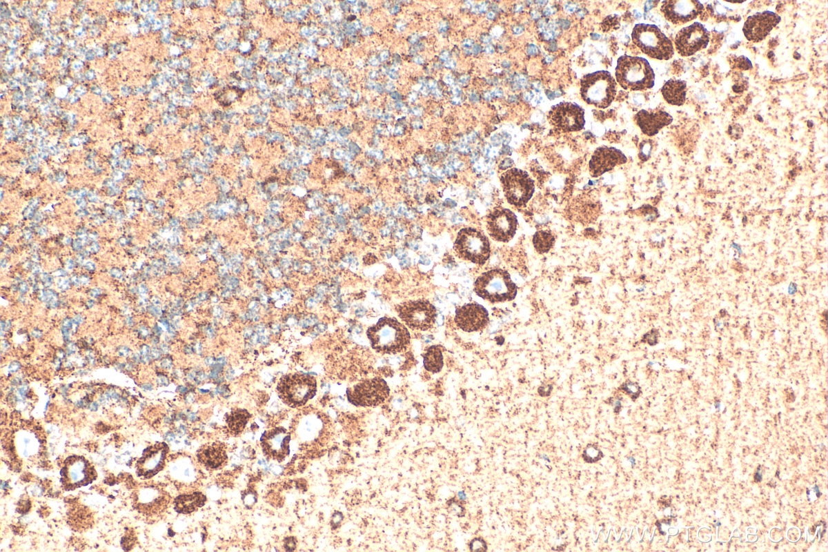 Immunohistochemistry (IHC) staining of mouse cerebellum tissue using TRPA1 Polyclonal antibody (19124-1-AP)