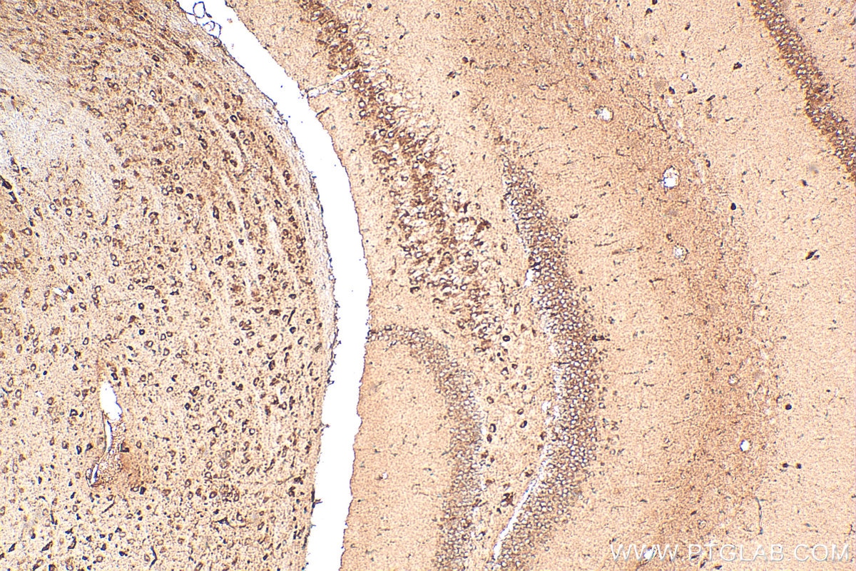 Immunohistochemistry (IHC) staining of mouse brain tissue using TRPA1 Polyclonal antibody (19124-1-AP)