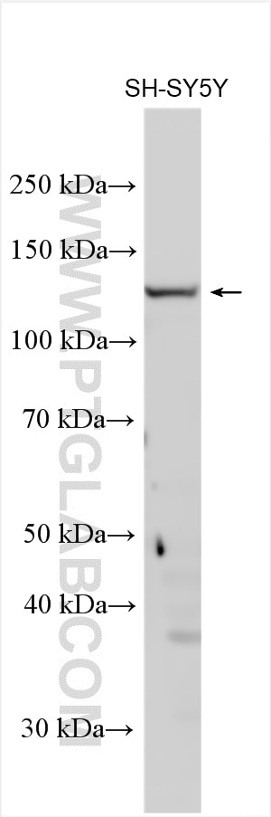 Western Blot (WB) analysis of various lysates using TRPA1 Polyclonal antibody (19124-1-AP)