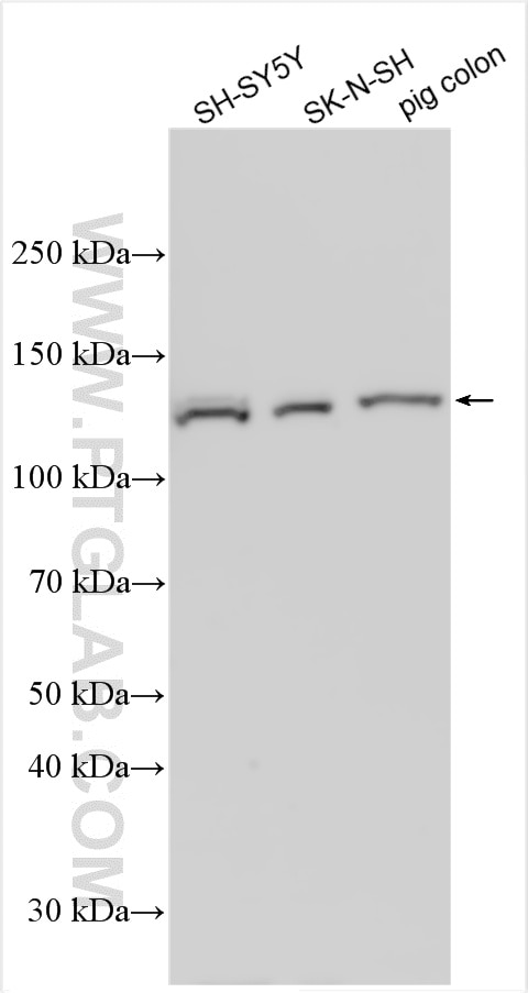 Western Blot (WB) analysis of various lysates using TRPA1 Polyclonal antibody (19124-1-AP)