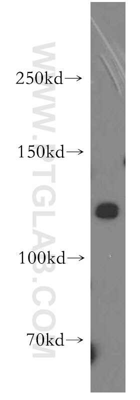 TRPA1 Polyclonal antibody