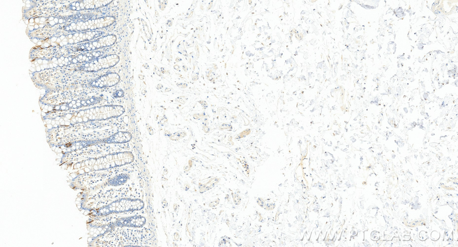 Immunohistochemistry (IHC) staining of human colon tissue using TRPA1 Recombinant monoclonal antibody (84986-3-RR)