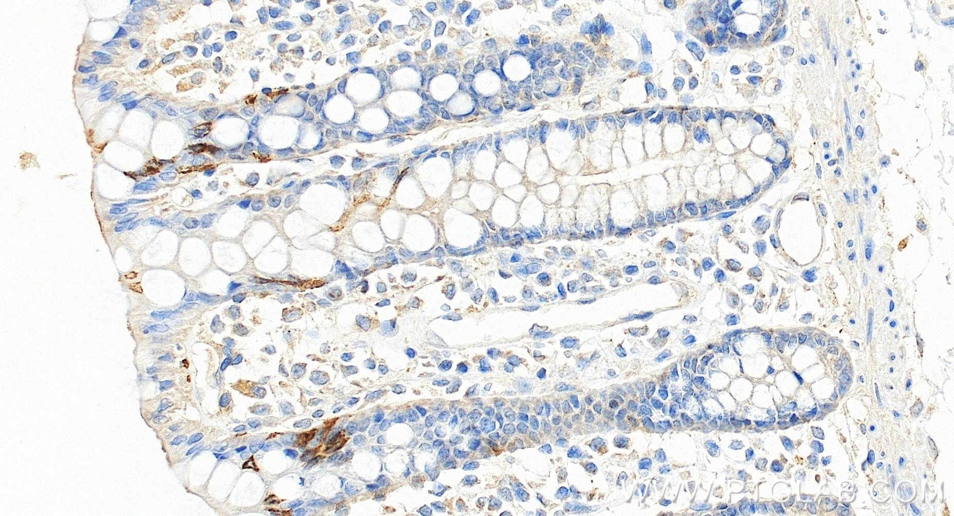 Immunohistochemistry (IHC) staining of human colon tissue using TRPA1 Recombinant monoclonal antibody (84986-3-RR)
