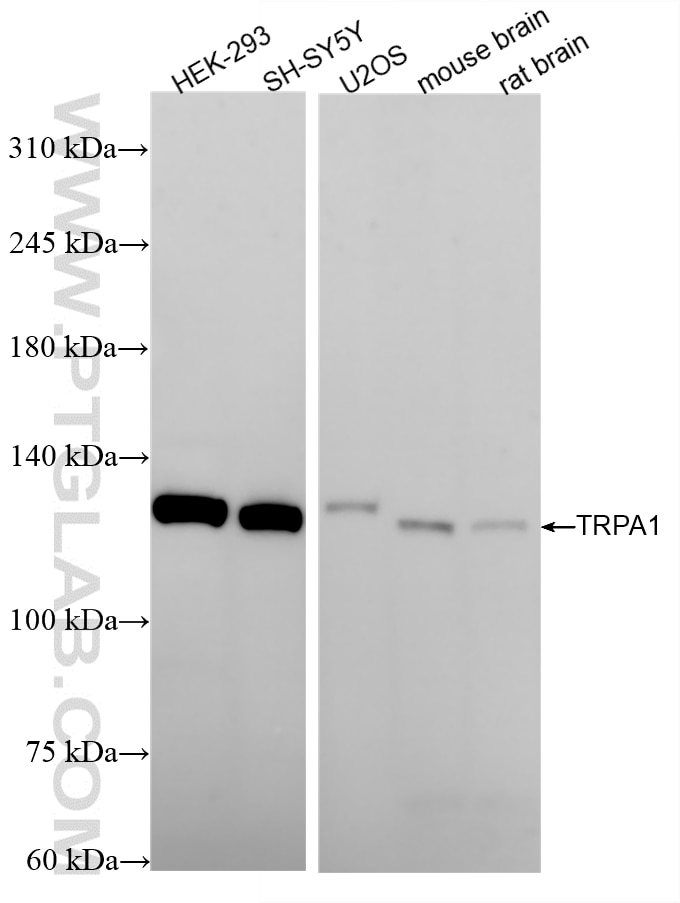Western Blot (WB) analysis of various lysates using TRPA1 Recombinant monoclonal antibody (84986-3-RR)