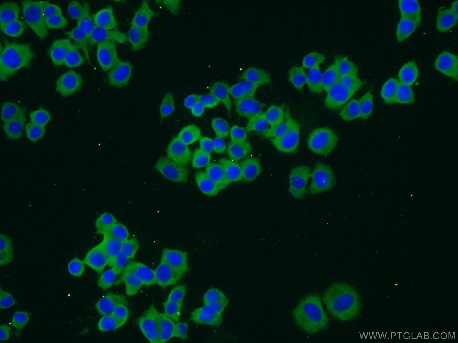 Immunofluorescence (IF) / fluorescent staining of PC-12 cells using TRPC1 Polyclonal antibody (19482-1-AP)