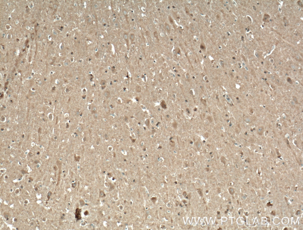 Immunohistochemistry (IHC) staining of human brain tissue using TRPC1 Polyclonal antibody (19482-1-AP)