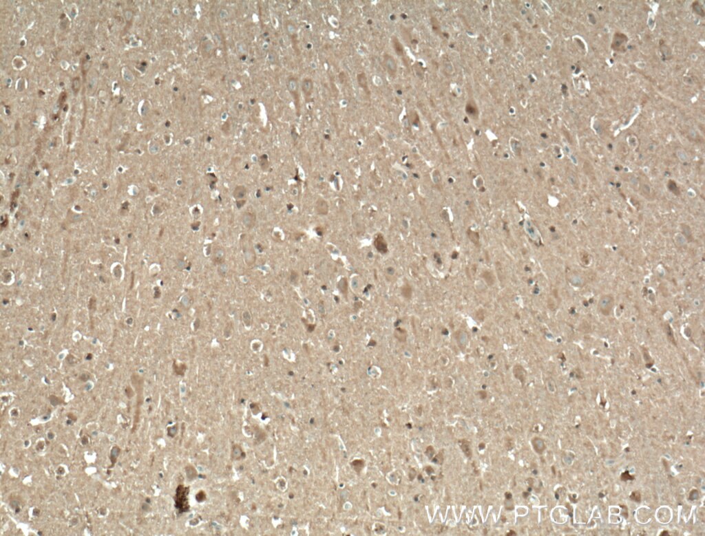 Immunohistochemistry (IHC) staining of human brain tissue using TRPC1 Polyclonal antibody (19482-1-AP)