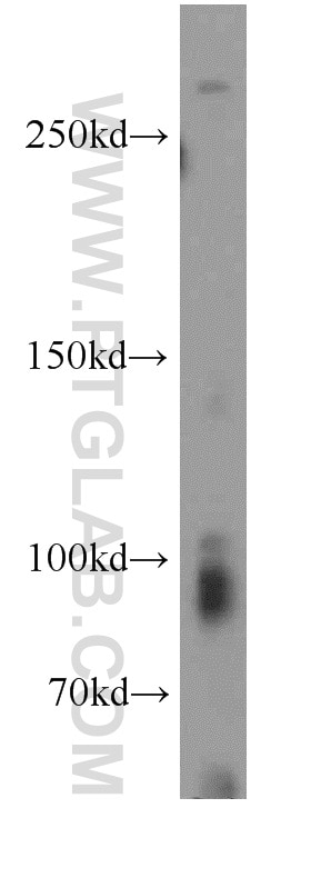 Western Blot (WB) analysis of human testis tissue using TRPC1 Polyclonal antibody (19482-1-AP)