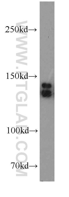 Western Blot (WB) analysis of SH-SY5Y cells using TRPC1 Polyclonal antibody (19482-1-AP)