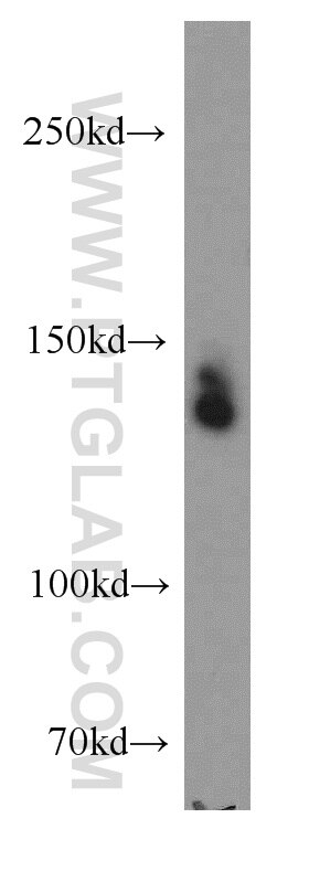 WB analysis of SH-SY5Y using 19482-1-AP