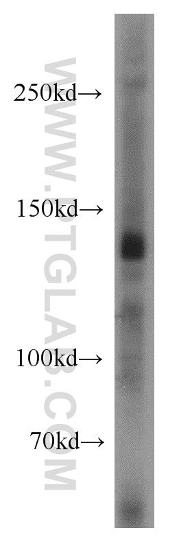 Western Blot (WB) analysis of mouse liver tissue using TRPC1 Polyclonal antibody (19482-1-AP)