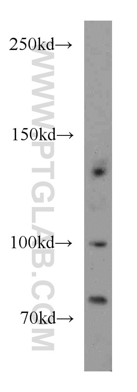 Western Blot (WB) analysis of PC-3 cells using TRPC1 Polyclonal antibody (19482-1-AP)