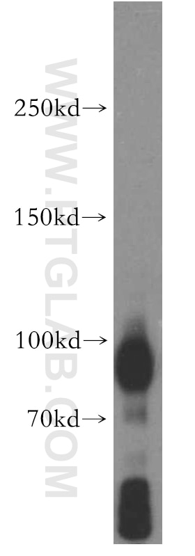 Western Blot (WB) analysis of human brain tissue using TRPC1 Polyclonal antibody (19482-1-AP)