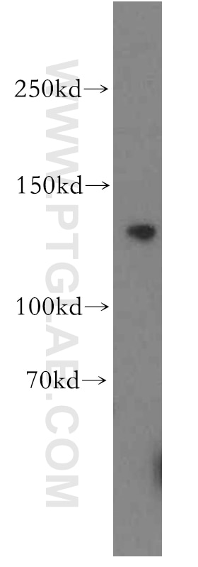 Western Blot (WB) analysis of PC-3 cells using TRPC1 Polyclonal antibody (19482-1-AP)
