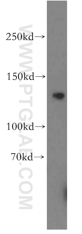 WB analysis of PC-3 using 19482-1-AP