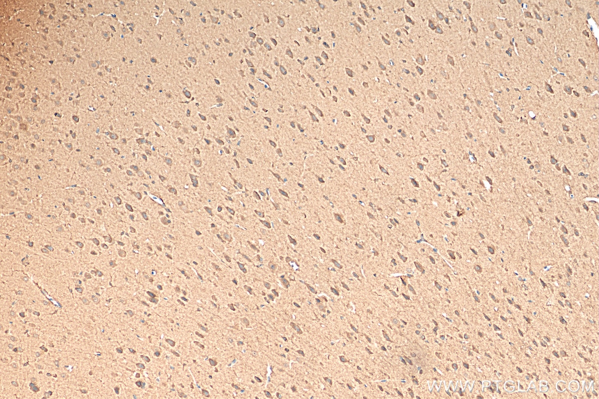 Immunohistochemistry (IHC) staining of rat brain tissue using TRPC1 Polyclonal antibody (24727-1-AP)