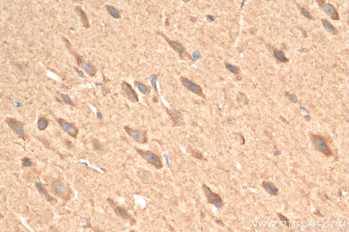 Immunohistochemistry (IHC) staining of rat brain tissue using TRPC1 Polyclonal antibody (24727-1-AP)