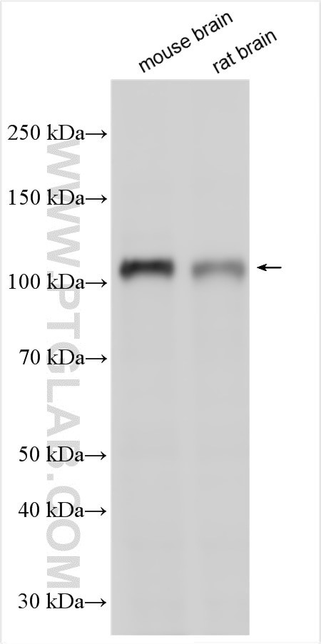 Western Blot (WB) analysis of various lysates using TRPC1 Polyclonal antibody (24727-1-AP)