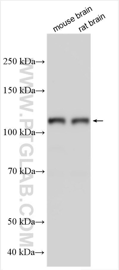 Western Blot (WB) analysis of various lysates using TRPC1 Polyclonal antibody (24727-1-AP)