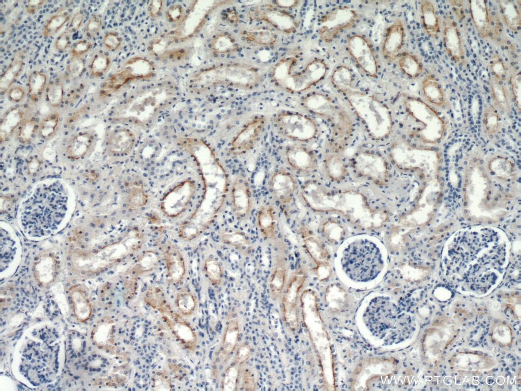 Immunohistochemistry (IHC) staining of human kidney tissue using TRPC4 Polyclonal antibody (21349-1-AP)