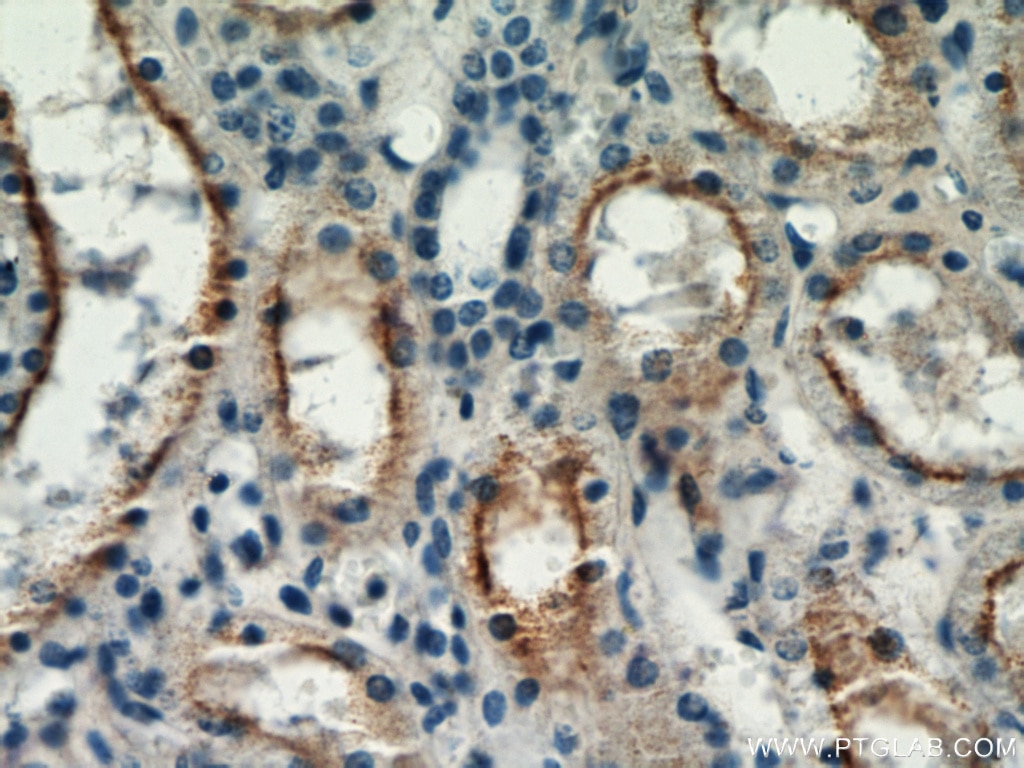 Immunohistochemistry (IHC) staining of human kidney tissue using TRPC4 Polyclonal antibody (21349-1-AP)