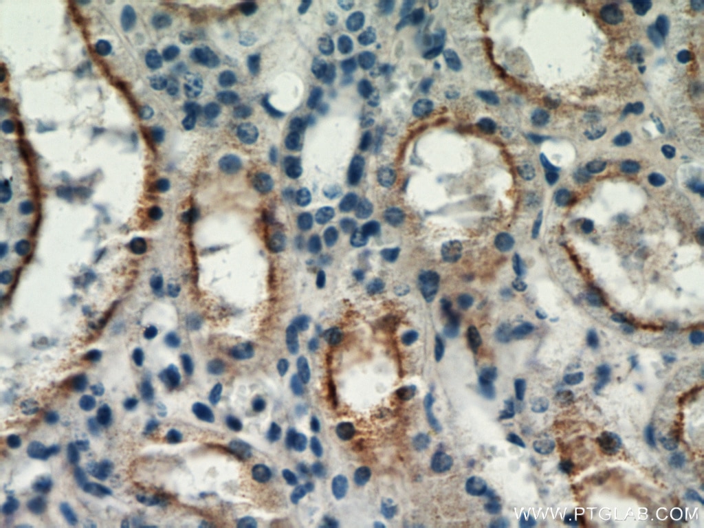 IHC staining of human kidney using 21349-1-AP