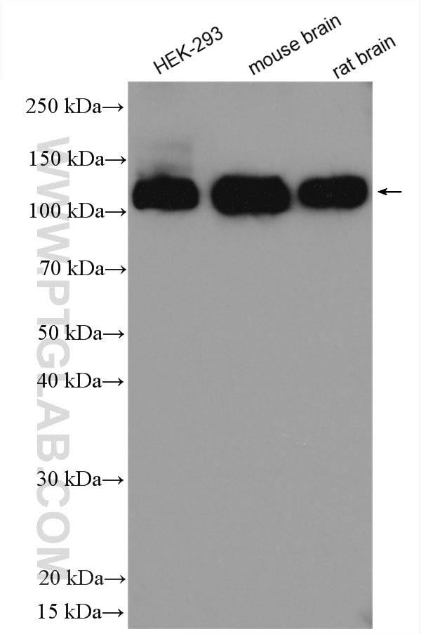 Western Blot (WB) analysis of various lysates using TRPC4 Polyclonal antibody (21349-1-AP)