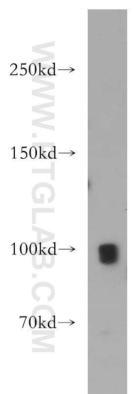 TRPC4 Polyclonal antibody