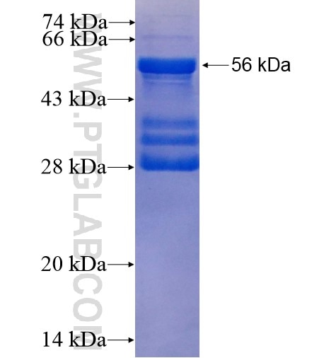 TRPC4 fusion protein Ag15698 SDS-PAGE