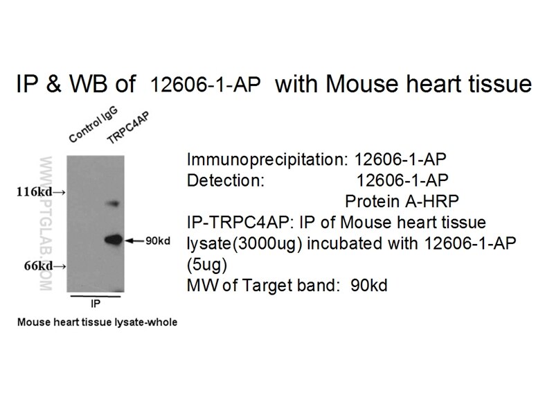 TRPC4AP