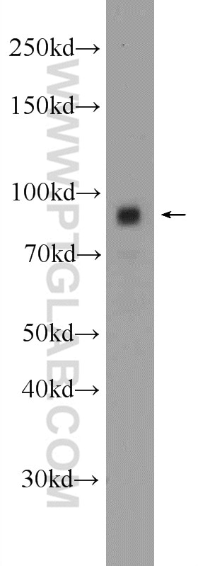 Western Blot (WB) analysis of human heart tissue using TRPC4AP Polyclonal antibody (12606-1-AP)