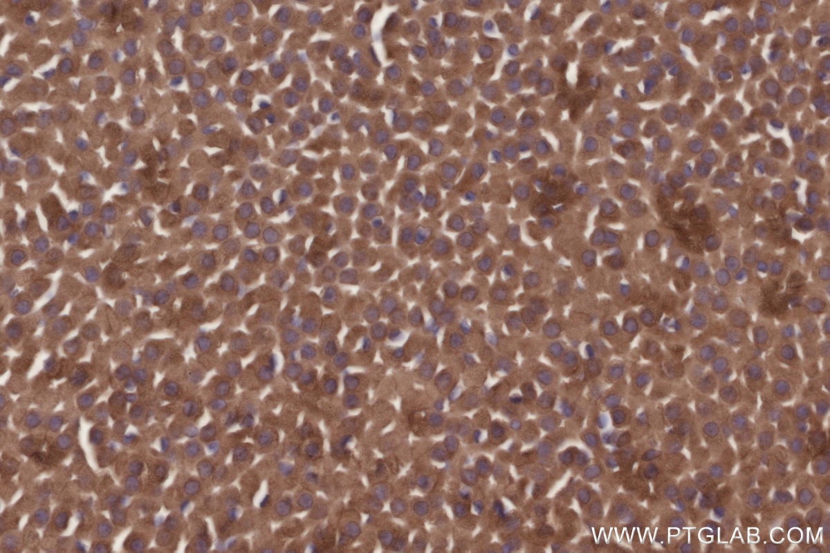 Immunohistochemistry (IHC) staining of mouse adrenal gland tissue using TRPC4AP Polyclonal antibody (29310-1-AP)