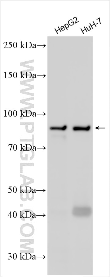 Western Blot (WB) analysis of various lysates using TRPC4AP Polyclonal antibody (29310-1-AP)