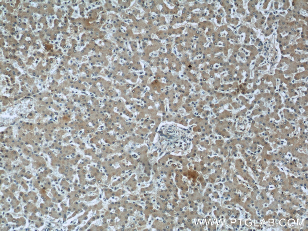 Immunohistochemistry (IHC) staining of human liver tissue using TRPC4AP Monoclonal antibody (66138-1-Ig)